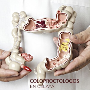 Coloproctologos En Celaya Conocelos Y Citas Aqu