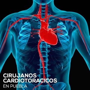 Cirujanos Cardiotoracicos en Puebla