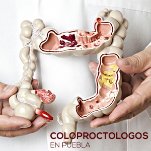 Coloproctologos en Puebla