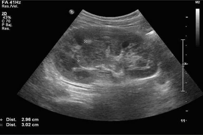 Ultrasonido Morfologico en Guadalajara 1