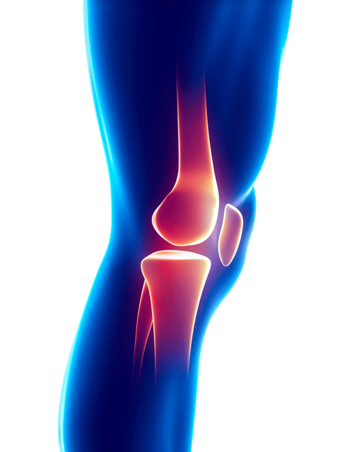 Cual es el precio de una artroscopia de rodilla en Guadalajara 1