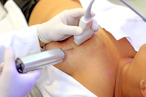 Biopsia de mama en Querétaro, Biopsias en Querétaro, Costo de biopsia de mama 3