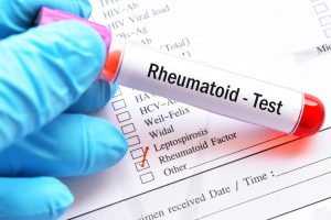 Factor-Reumatoide-300x200