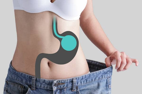 Balon Gastrico en Aguascalientes 1