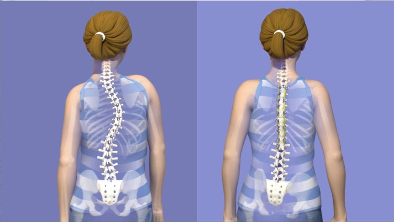 ▷ Huesos de la espalda: anatomía y patologías【2020】