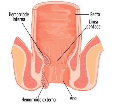 Coloproctologos en Veracruz, Coloproctologos en Boca del Rio Veracruz, Coloproctologos en Huatusco Veracruz, Coloproctologos en Xalapa Veracruz 5