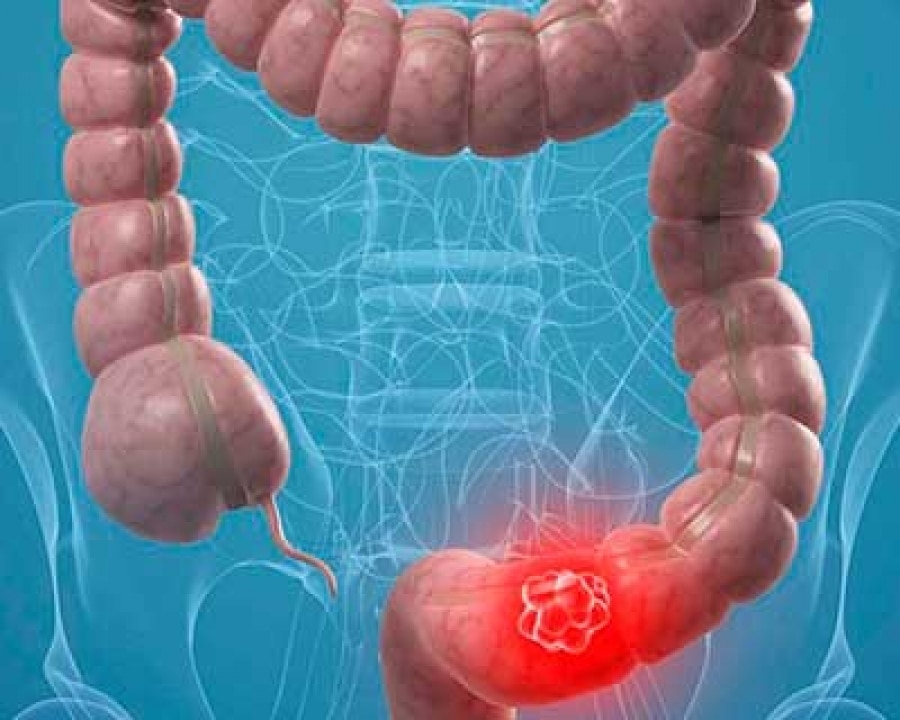 Coloproctologos en Veracruz, Coloproctologos en Boca del Rio Veracruz, Coloproctologos en Huatusco Veracruz, Coloproctologos en Xalapa Veracruz 11