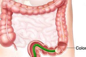 Coloproctologia