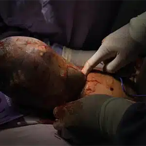 Td-Dr. Sergio Palmeros Morales 8